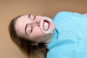 Female patient lies on the dentist's chair with her mouth open