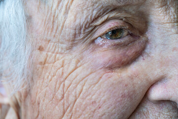 close up eye of old person crying
