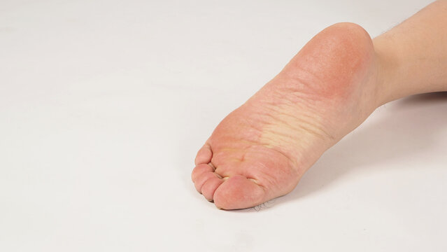 Asian Male soles barefoot are isolated on white background.