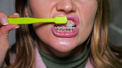 Young brunette woman brushes teeth with dental braces thoroughly using green toothbrush looking in mirror in bathroom against grey tile, closeup.