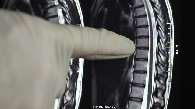 Detail of spine cat scan.mov
