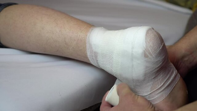 Ligation of the ankle joint with a bandage