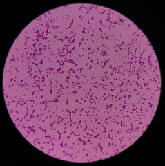 Escherichia coli bacterium, E.coli, gram-negative rod-shaped bacteria, normal flora in GI tract and...