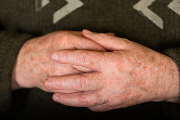 Elderly hands