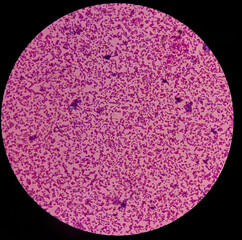 Enterobacter bacterium, gram-negative rod-shaped bacteria, facultative anaerobes bacteria,...