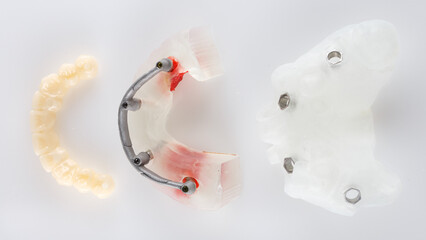 Technical kit for total dental implantation, from a surgical template to a temporary prosthesis