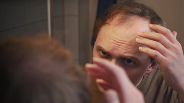 A young man with a bald patch on his head looks desperately at himself in the mirror (2)