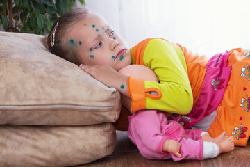 The girl is sick with chickenpox