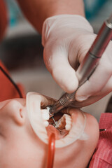 Dentist cleans tooth decay in a child with a drill, in the child's mouth ejector saliva.