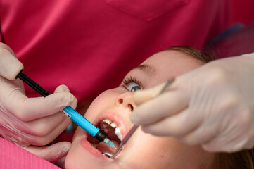 Treatment of baby teeth in a child, a visit to the dentist.