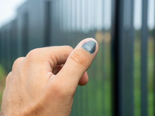 Close-up of a thumped thumb. Blurred background. Injury at work, bruise, hematoma. Selective focus