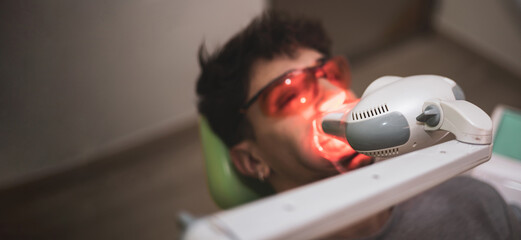 a man with arab features undergoing laser teeth whitening treatment to remove stains in a dental...
