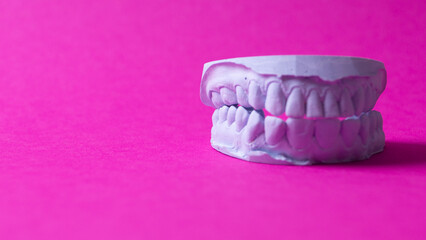 ceramic model of human teeth.
