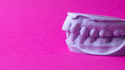 ceramic model of human teeth.