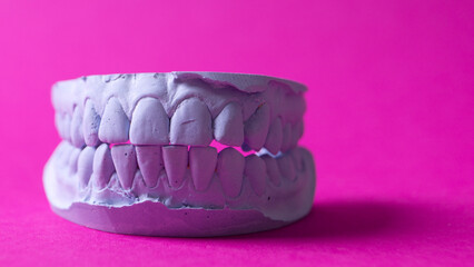 ceramic model of human teeth.