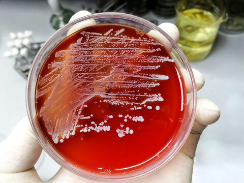 Staphylococcus aureus: Gram-positive, to Gram-variable, nonmotile, Coccus, beta hemolysis, saprotrophic bacterium that belongs to the family Staphylococcus growth on blood agar.