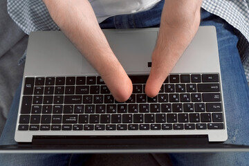 Disabled man with amputated two stump hands working typing on laptop at home sitting on sofa, hands closeup. Problem of adaptation to life people with disabilities. Independent Invalid person.