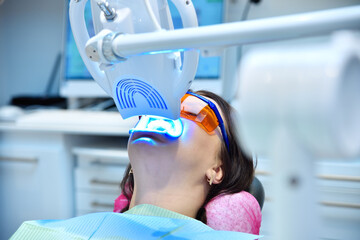 Laser bleaching teeth in clinic. - obrazy, fototapety, plakaty