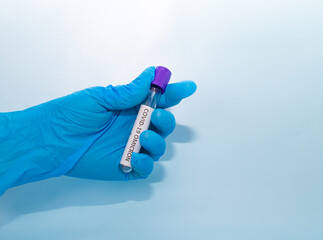 Vacuum tube for collection and blood samples in blue gloves for laboratory. On blue background
