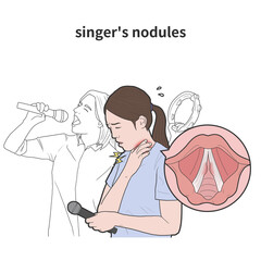 성대결절로 노래부르기 힘든 여성