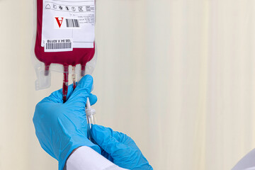 A doctor checking on a blood bag to start transfusing blood to the patient.  Blood transfusion and...
