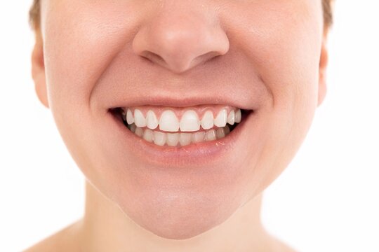 Lower half of woman face close up, smile with open mouth and white healthy teeth