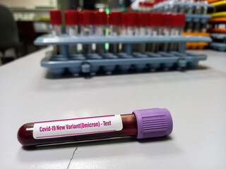 Blood sample for New Variant of Covid-19 Omicron B.1.1.529 test. A generic of covid-19 Coronavirus Mutations. Doctor in analysis lab holding sample of new strain of covid Omicron