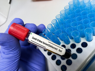 Researcher hold blood sample for New Variant of Covid-19 Deltacron test(‘super variant’...