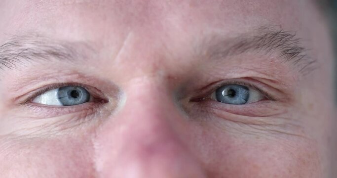 Male blue eyes with nervous tics and strabismus closeup