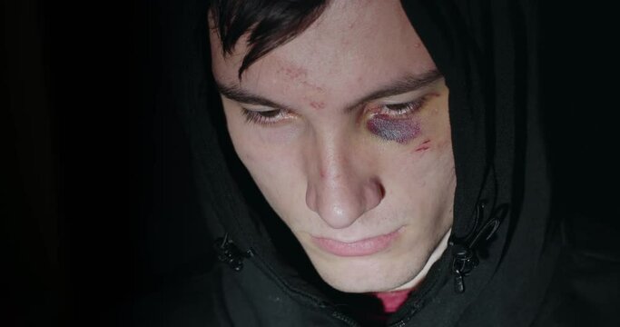 Young man with a bruise under his eye - a victim of domestic violence concept