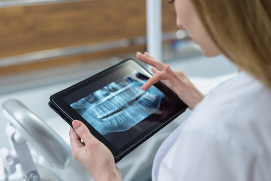 Dentist examines panoramic tooth x-ray image using tablet