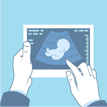Ultrasonography picture, ultrasound scan of fetus in hands, pregnancy symbol, vector