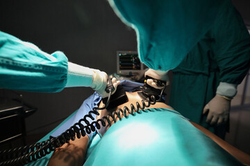 Closeup image of professional concentrated surgical team performing CPR with defibrillator on patient in hospital operating room or emergency room. Surgery concept - obrazy, fototapety, plakaty