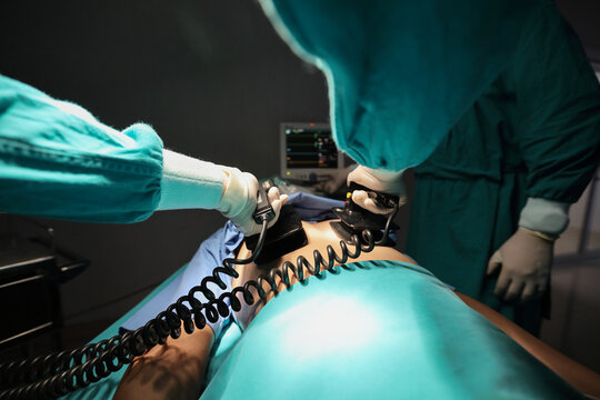 Closeup image of professional concentrated surgical team performing CPR with defibrillator on patient in hospital operating room or emergency room. Surgery concept