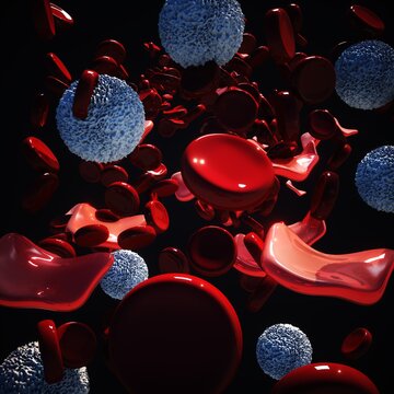 Thalassemia, illustration