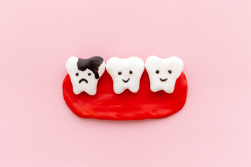 Oral health concept. Healthy and caries teeth models on gums