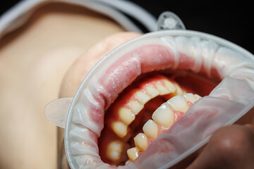 Obraz premium Close-up of teeth, dental checkup in the dental office. The dentist examines the patient's teeth with dental instruments. Dentistry. selective focus