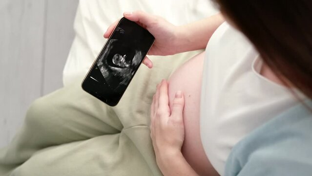Top view cropped of pregnant woman looking ultrasound video on phone of fetus standing at home, young future mom waiting child first baby, pregnancy and motherhood concept