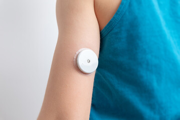 Blood glucose sensor on a child's arm.  Sensor for remote measurement of blood glucose levels using NFC technology on a mobile phone or reader - obrazy, fototapety, plakaty