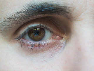 Brown eye detail of man with vision problems