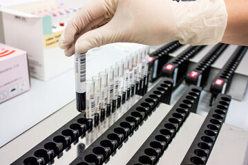 Sorting blood tubes into racks in the analysis laboratory
