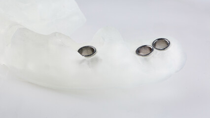 Dental template with titanium sleeves for implantation on a white background