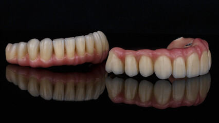 excellent composition of two dental prostheses made of metal and ceramics with pink gums, photo on...