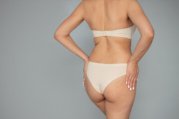 Young woman on a light background. Cellulite problem concept
