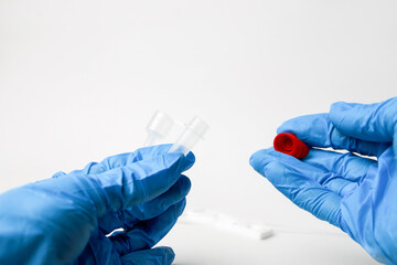 Man makes a covid-19 antigen pcr test macro. The test showed a positive result.