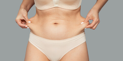The girl tightens the skin on her stomach, showing fat deposits in the abdomen and sides. Treatment...