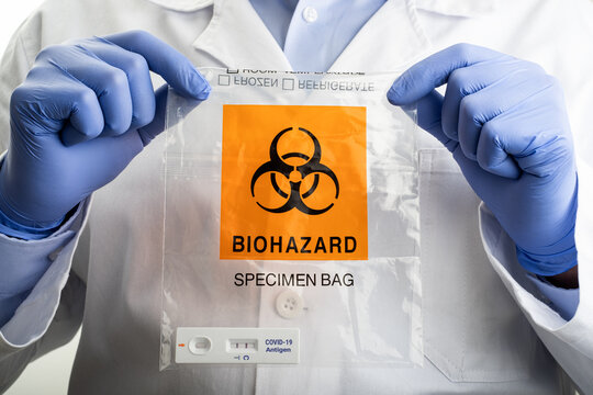 Doctor in gloves  holding Biohazard Specimen Bag with Positive PCR Antigen Test, Copy space pandemic concept