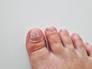 feet bad exfoliating nails, pedicure