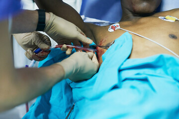 Surgically skilled in chest intubations. Cropped shot of a doctor inserting a tube into a patients...