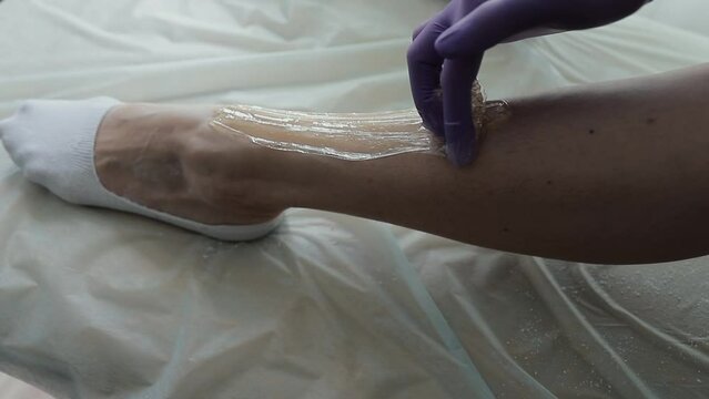 sugaring process, a gloved hand applies sugaring paste to the shin